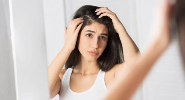 How to remove dandruff from hair without washing?
