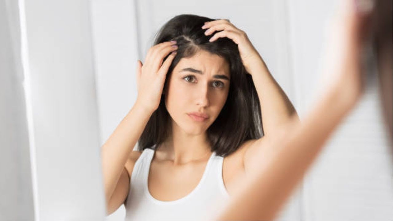 How to remove dandruff from hair without washing?